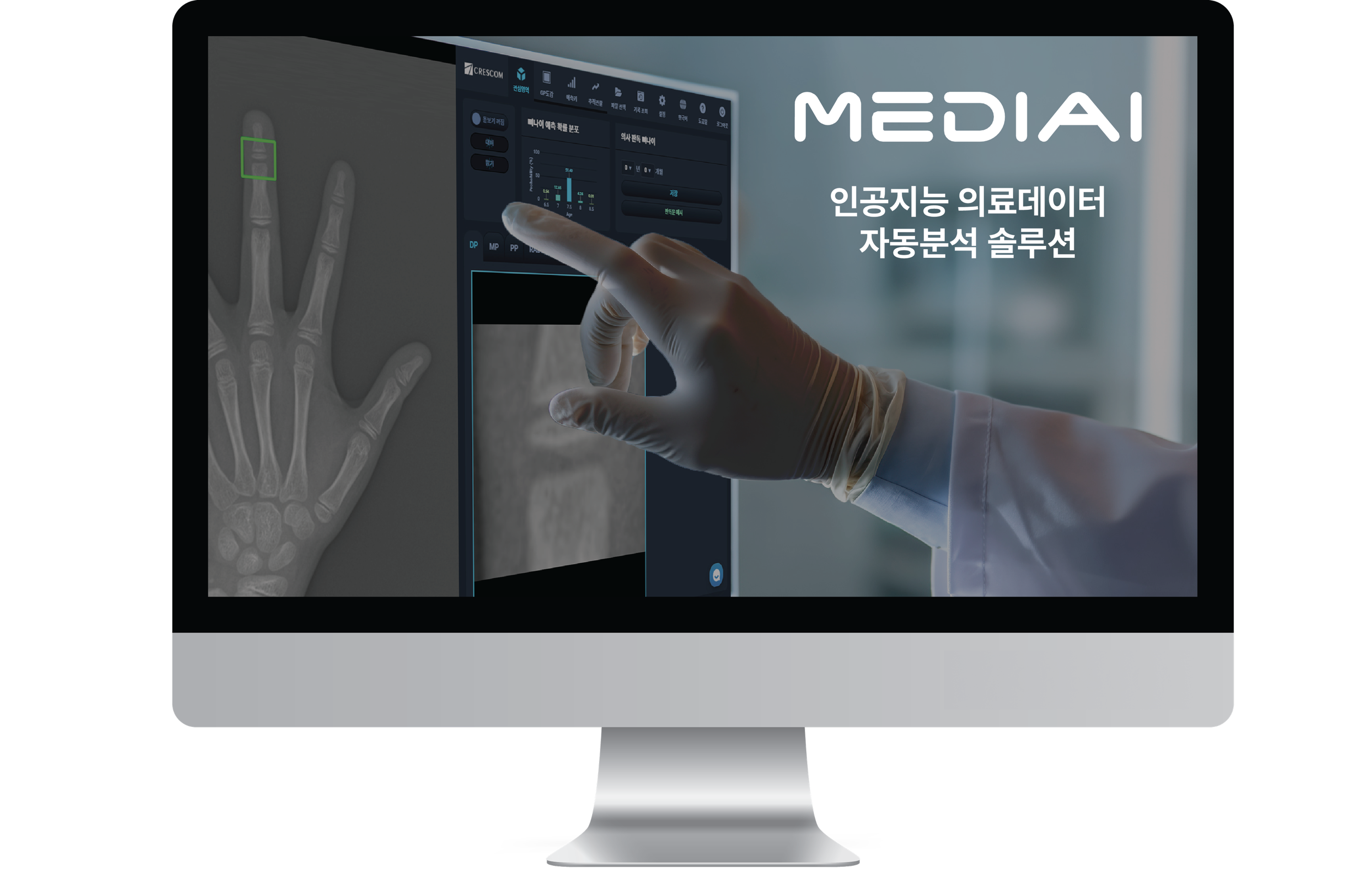 수완부 X-ray 성장판 검사를 분석하는 토탈 성장 진단 화면